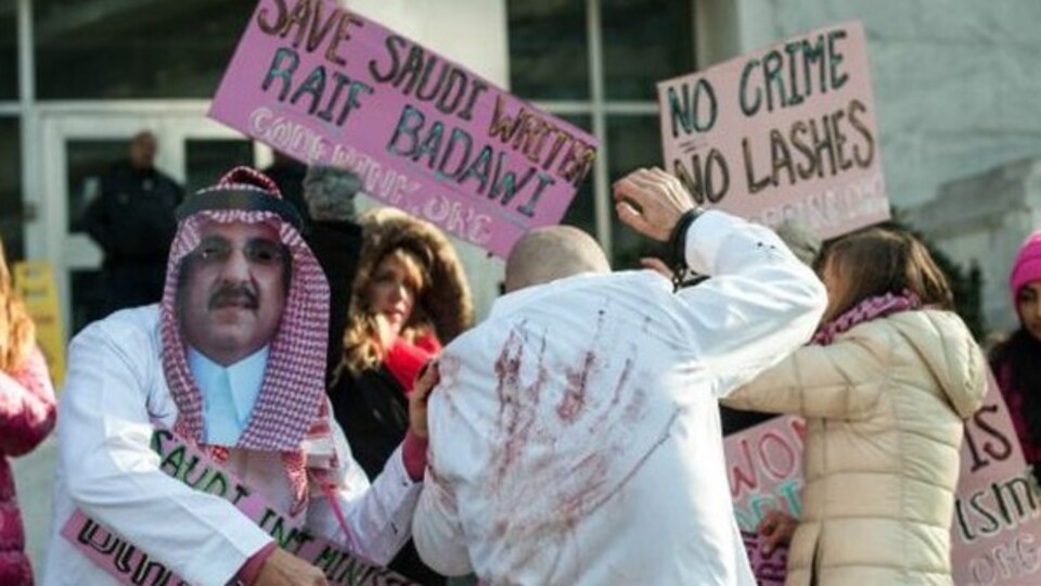 Yaraları iyileşmeyince kırbaç cezası ertelendi