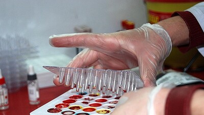 TÜRKÖK dünyaya da umut olacak