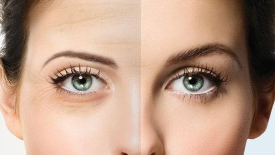 Sarkık göz kapağı yaşlı gösteriyor