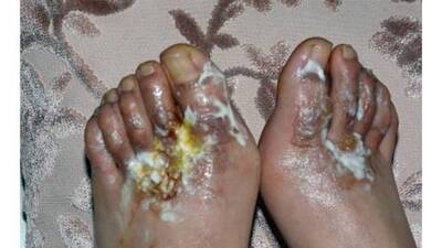 Yeni aldığı botlar bu hale getirdi