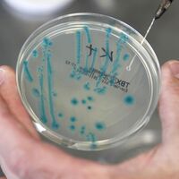 Hastanede gizemli bakteri iddiası!