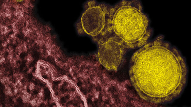 Muğla'da MERS virüsü şüphesi
