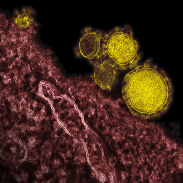 Muğla'da MERS virüsü şüphesi