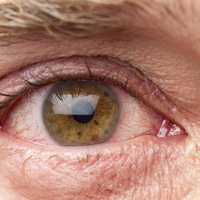 Gözdeki görünmez tehlike
