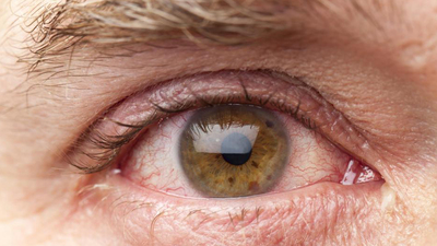 Gözdeki görünmez tehlike