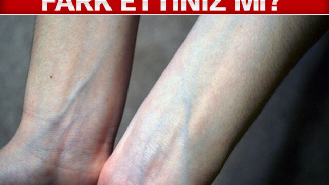 Kanımız kırmızı peki ya damarlarımız?