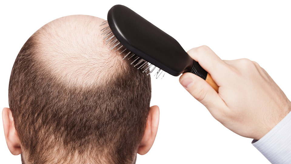 Kellik neyin habercisi?