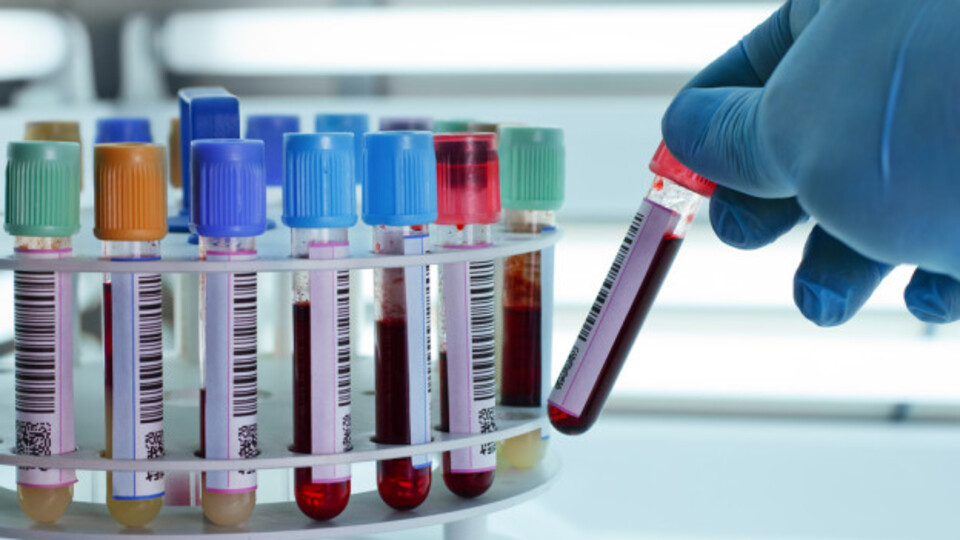 Aman dikkat! Yanlış kan testi hayatınıza mal olabilir