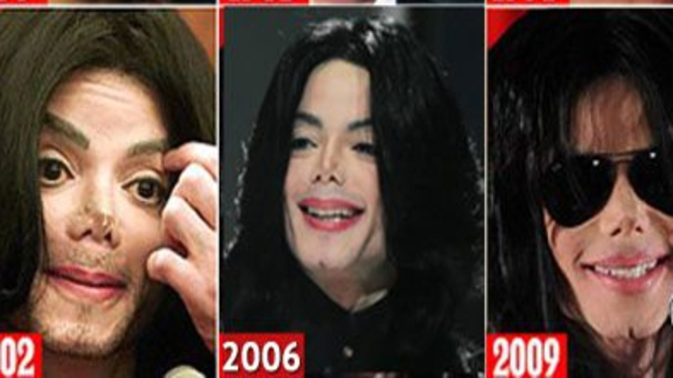 Estetik macerası belgesel oldu