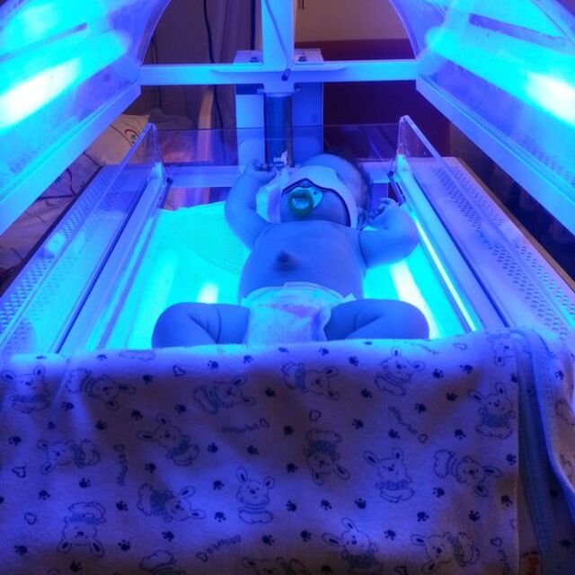 Poyraz'a fototerapi cihazı bağışlandı