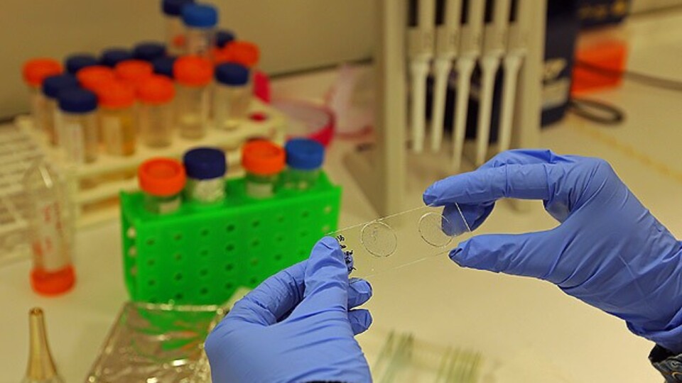 Kanser tedavisinde çığır açacak keşif