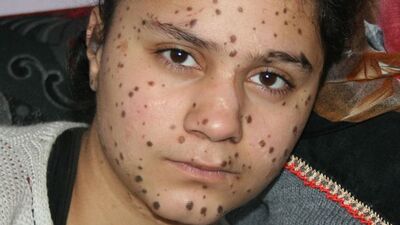 13 yaşındaki kızın yürek yakan feryadı