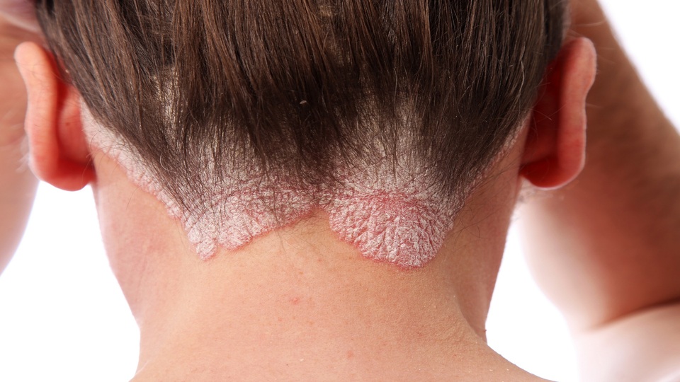 Türkiye'de hızla artıyor!