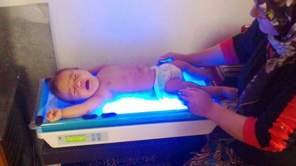 Koşullar aynı, fototerapi cihazı yeni