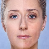 Göz altı torbaları yaşlı gösteriyor