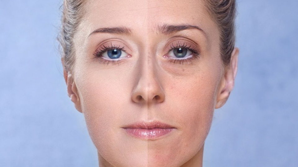 Göz altı torbaları yaşlı gösteriyor