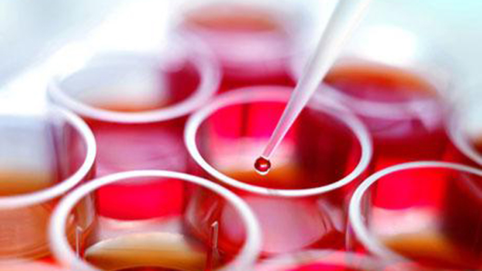 Kök hücre tedavisiyle görecekler