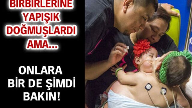 İşte 26 saat süren ameliyatın sonu!