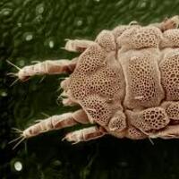 Ev tozları (Mite) tehlike saçıyor!