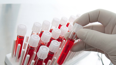 Kızılay'dan özel test