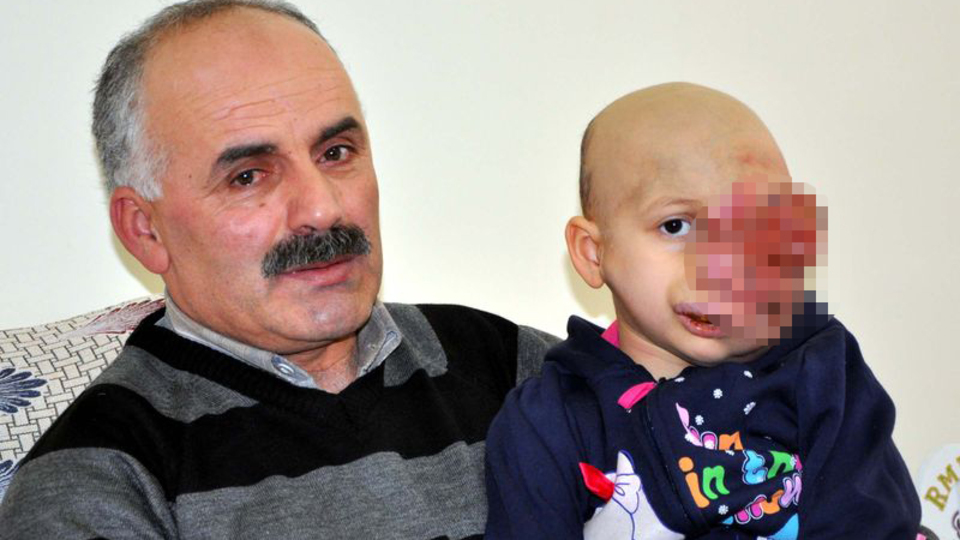 Yanlış tedavi küçük kızın hayatını kararttı