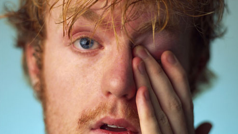 Gözlerinizi sakın kaşımayın!