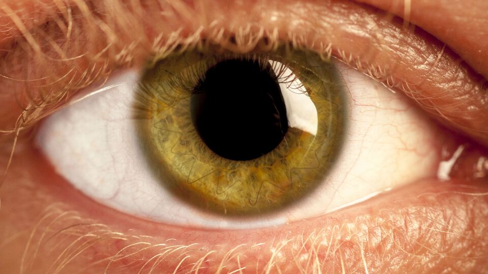 AYM'den izinsiz kornea nakline vize