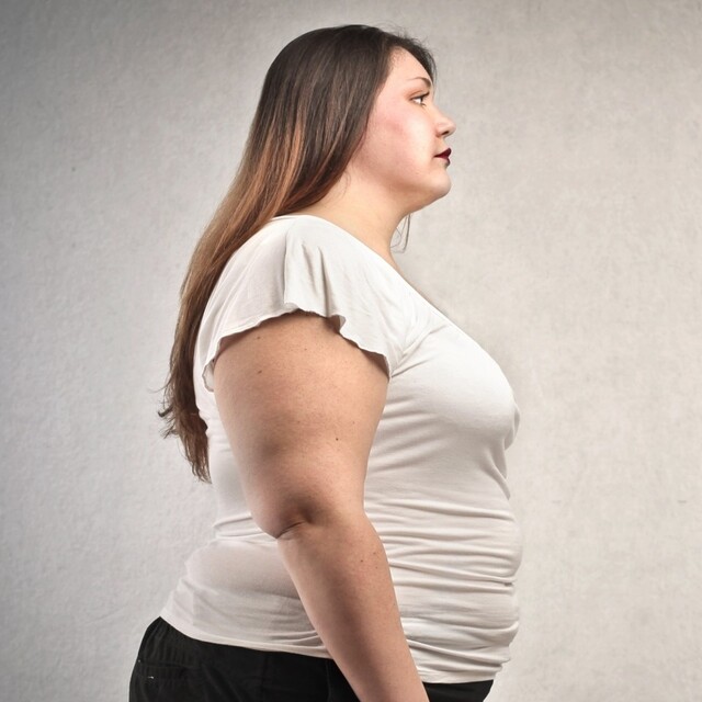 "Uzun süreli diyetler obezite sebebi"