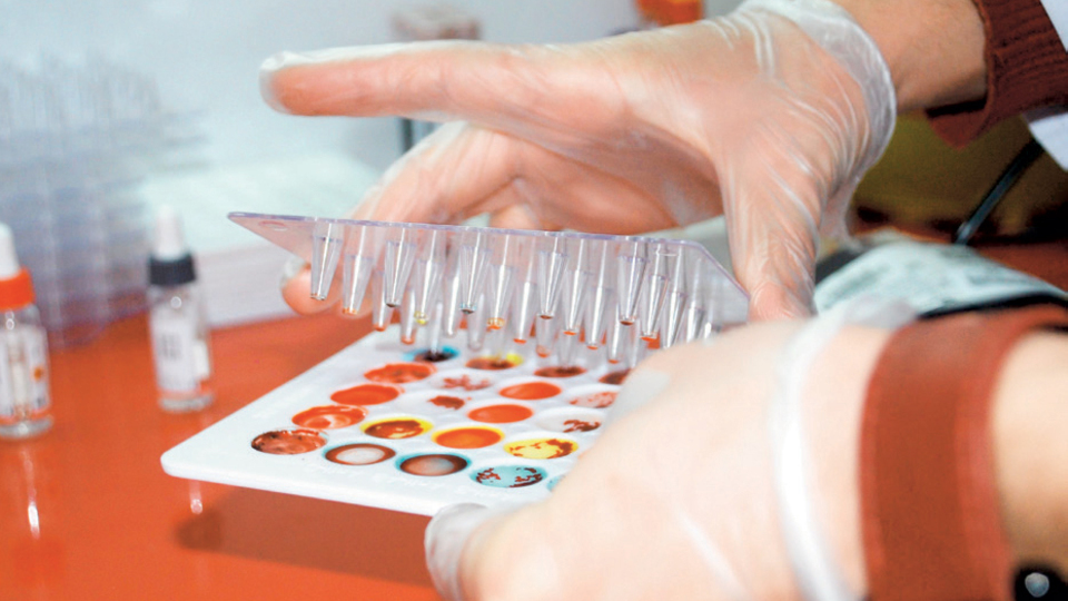 Kök hücrede eşleştirmeler başlıyor