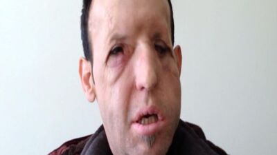 Recep Sert'ten sağlık durumuyla ilgili açıklama