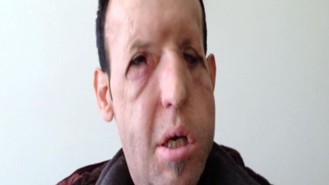Recep Sert'ten sağlık durumuyla ilgili açıklama