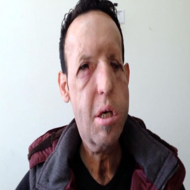 Recep Sert'ten sağlık durumuyla ilgili açıklama