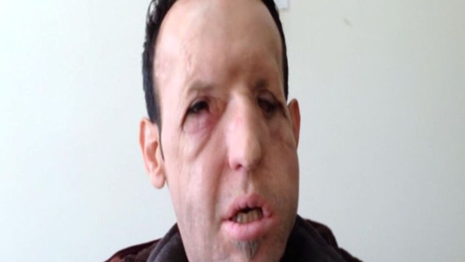 Recep Sert'ten sağlık durumuyla ilgili açıklama