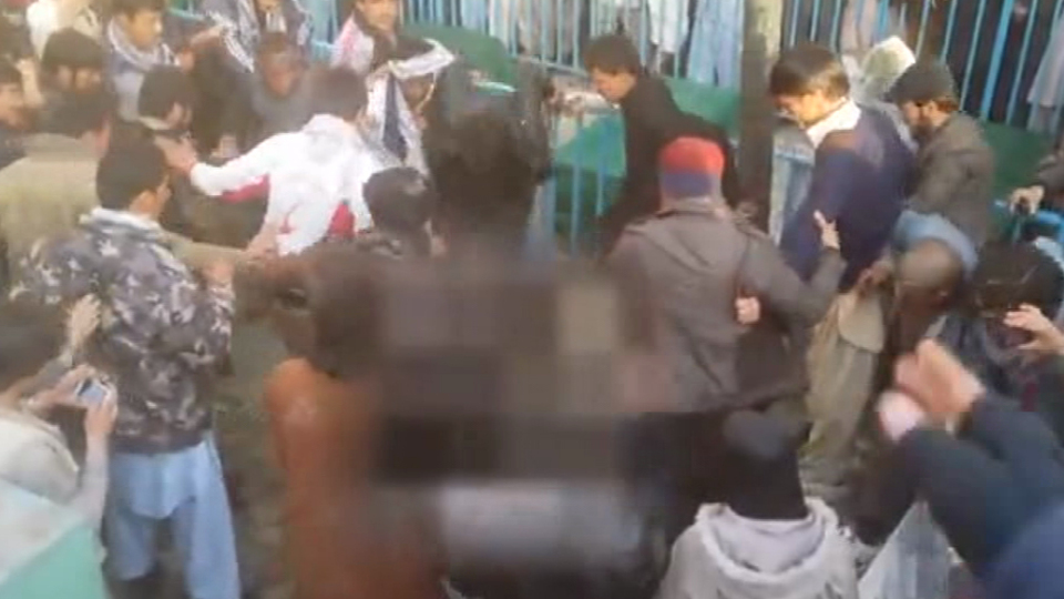 Zihinsel engelli kadına yaptıklarına inanamayacaksınız