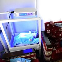 Poyraz bebek nakil olamıyor