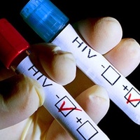 AIDS salgını alarmı!
