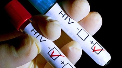 AIDS salgını alarmı!