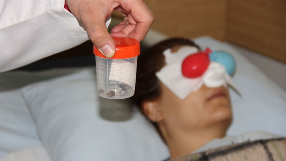 30 yıl böyle yaşamış! Burnundan çıktı