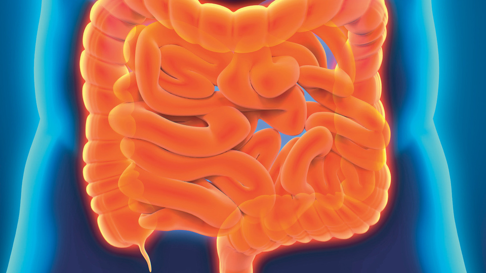 Kolon kanseri artıyor