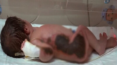 Bebeği ısıtacağız diye yaktılar!