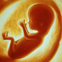 Anne karnında Down Sendromu testi