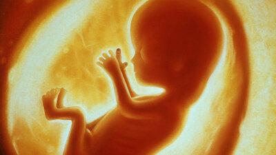 Anne karnında Down Sendromu testi