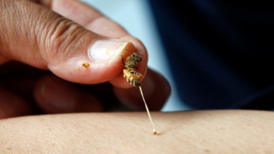 Arı zehri tedavi için kullanılacak