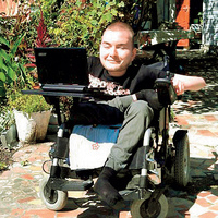 İlk kafa naklinin donörü olacak