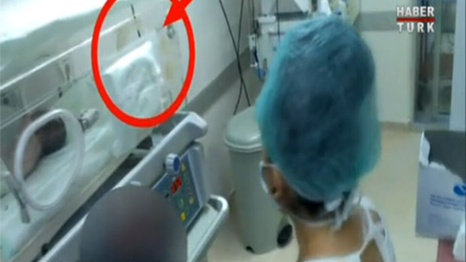 Özel hastanede skandal görüntü!