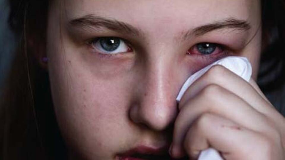 Baharla gelen göz alerjisine dikkat!