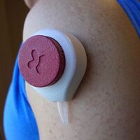 İğneden korkanlar için devrim!