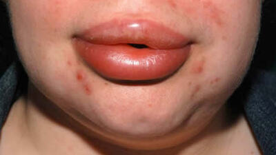 Tekrarlıyorsa ölümcül olabilir!