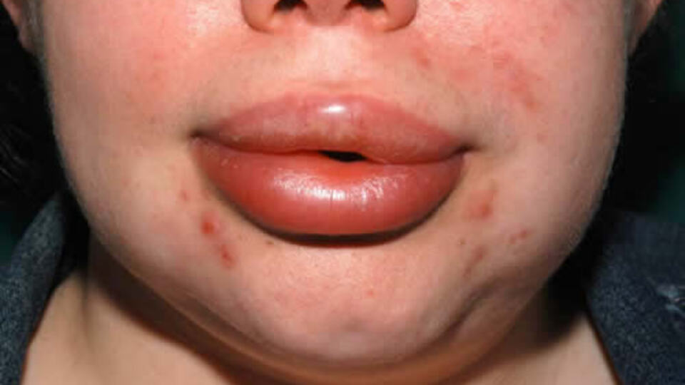 Tekrarlıyorsa ölümcül olabilir!