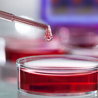 O tedavi artık Türkiye'de!